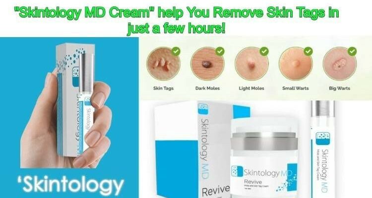 Skintology MD Reviews: Is it a Scam?